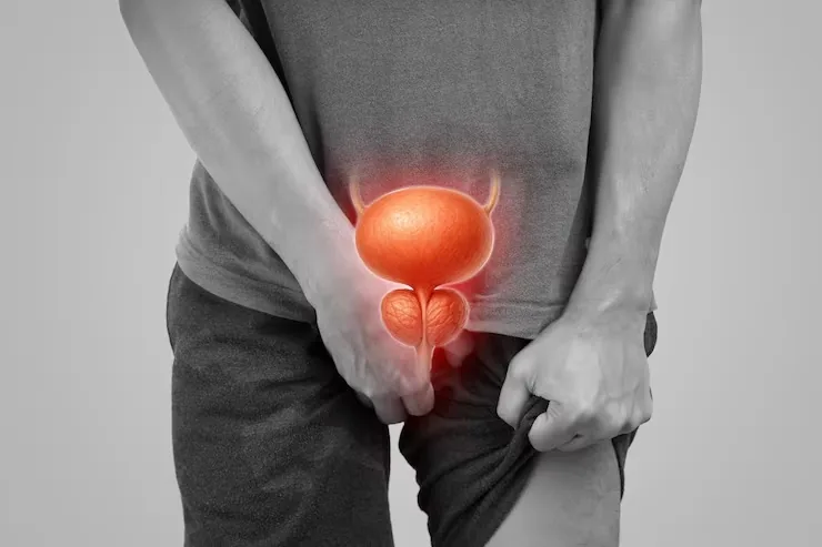 Prostate Health